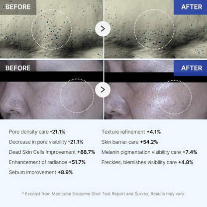 Medicube One Day Exosome Shot 7500 | Optimizes Cell Renewal